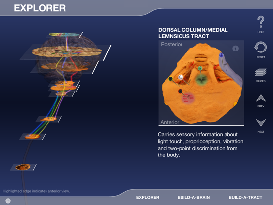 Screenshot #5 pour Build-A-Brain Explorer