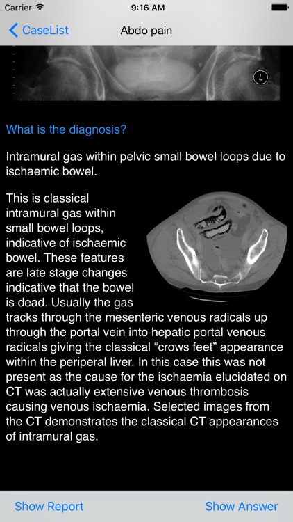 Xrays4Medics screenshot-4