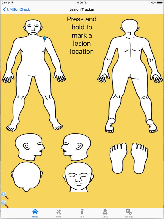 Screenshot #5 pour UMSkinCheck