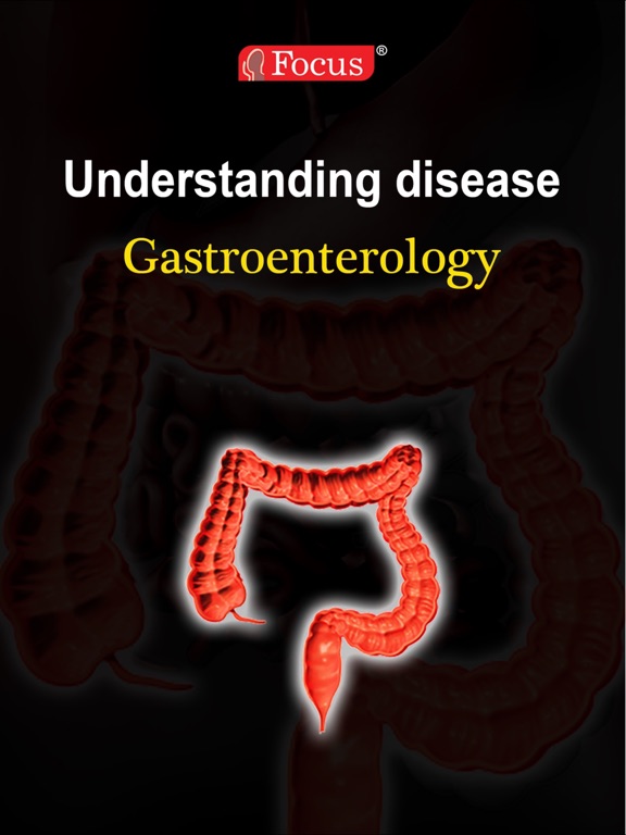 Screenshot #4 pour Gastroenterology - Understanding Disease