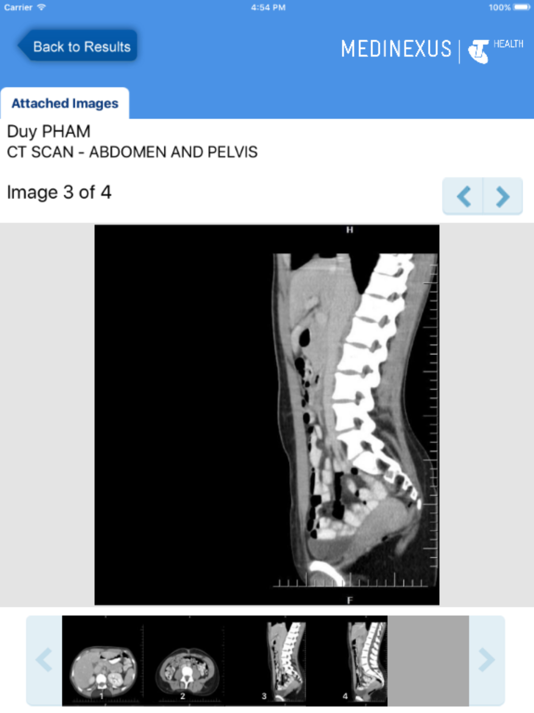 Medinexus Mobile for Patients screenshot 10