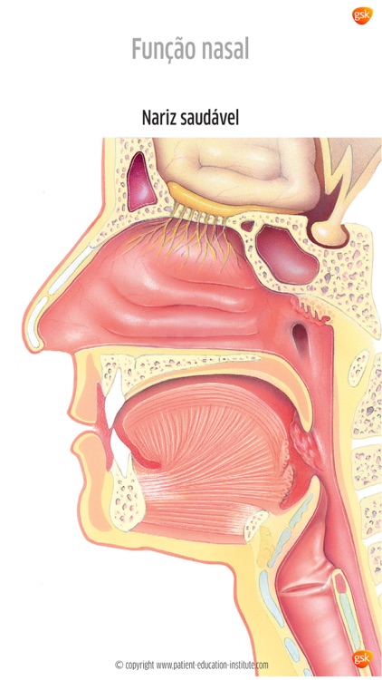 ORL Atlas GSK, iPhone