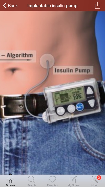 1000 Diabetes Reference and Medical Dictionary