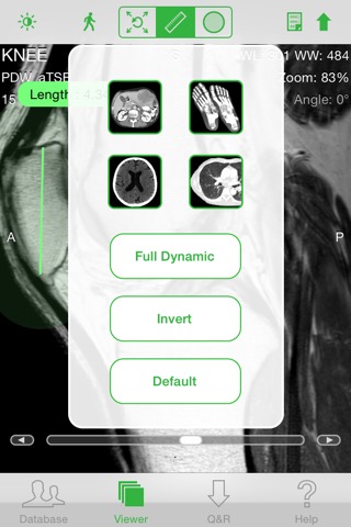 OsiriX HDのおすすめ画像2