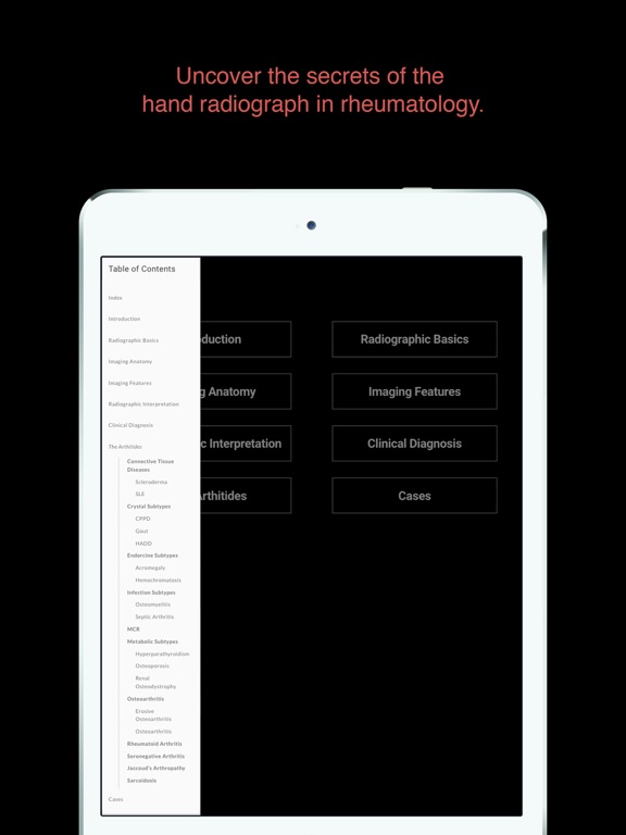 Screenshot #6 pour ESIMR: Uncovering The Hand Radiograph