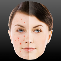 Perfect Face - Pimple Mole and Scar Remover