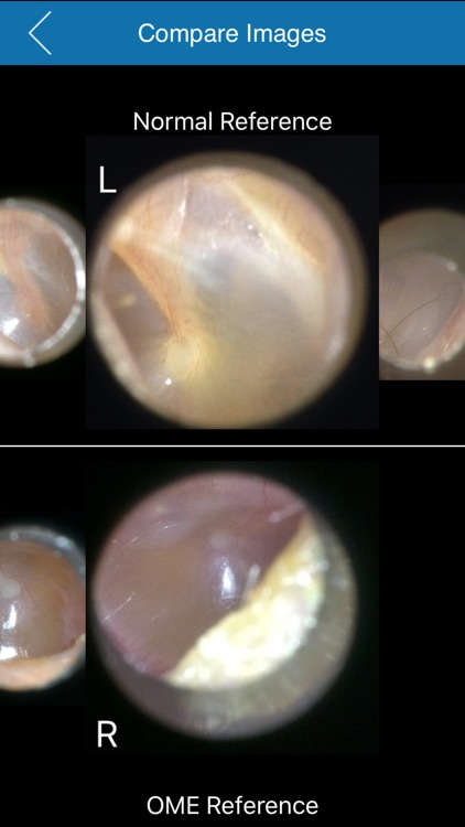 CellScope - Oto For Clinicians