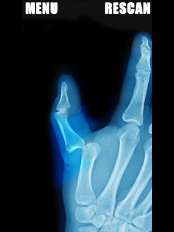 Screenshot #4 pour Simulator X-Ray - Finger Prank