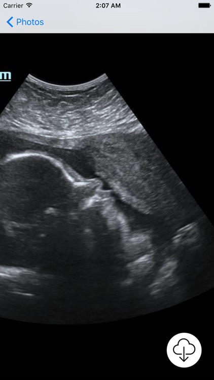 Your Baby Scan - Photo Locker