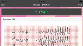 Game screenshot ECG Master - Quiz, Exam, Explanation, Statistic apk