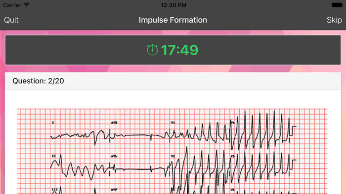 ECG Master - Quiz Exam Explanation Statistic