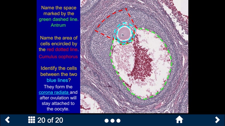 Histology Lite - SecondLook screenshot-4