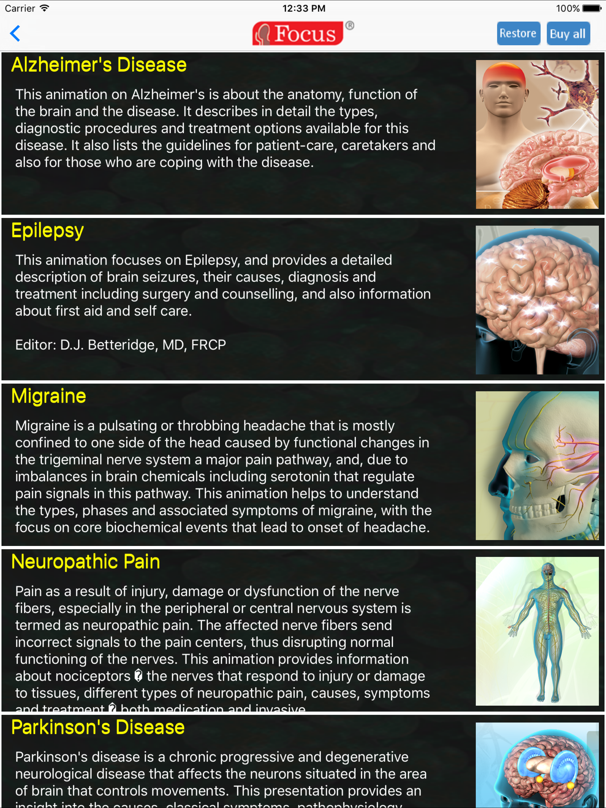 Neurology - Understanding Disease