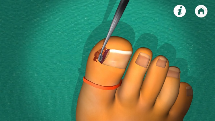 Podiatry 3D (Free Version) screenshot-4