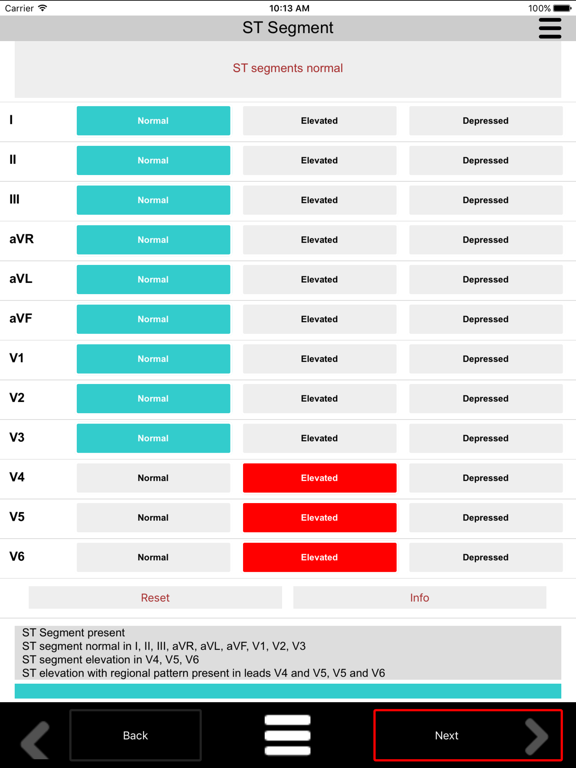 Screenshot #6 pour ECG Calc Lite