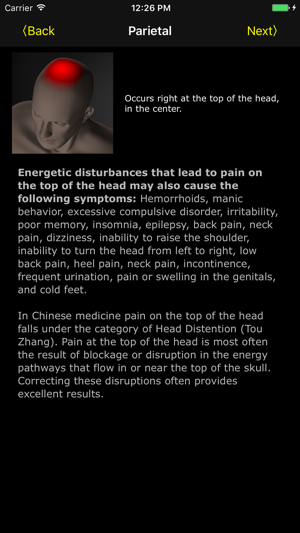 Headache(圖2)-速報App