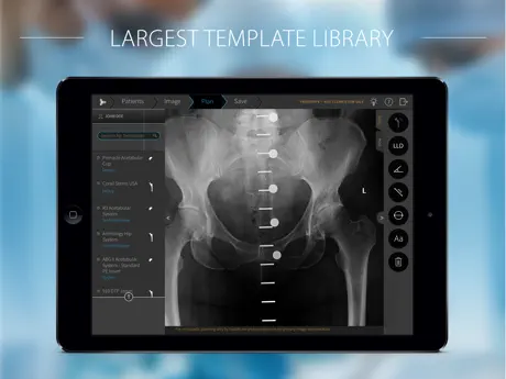 TraumaCad Mobile