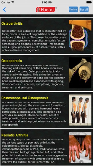 Orthopaedics - Understanding Disease(圖2)-速報App