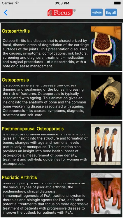 Orthopaedics - Understanding Disease