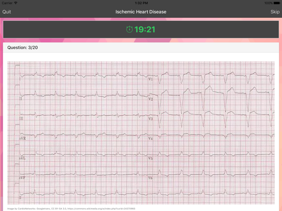 ECG Master - Quiz, Exam, Explanation, Statisticのおすすめ画像3