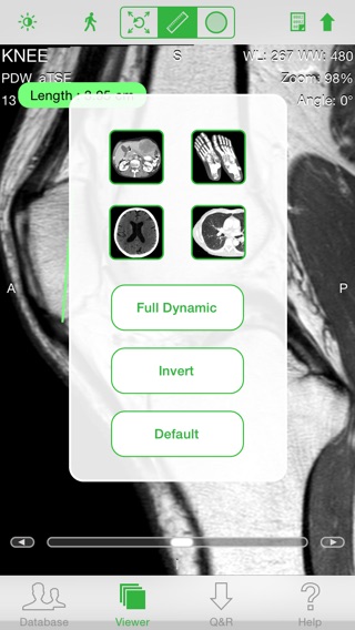 OsiriX HDのおすすめ画像3