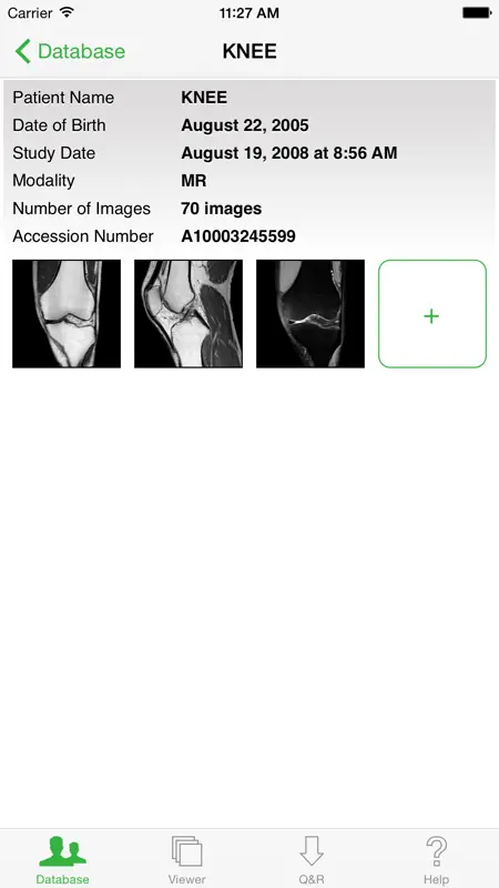 OsiriX HD screenshot 4 of 5