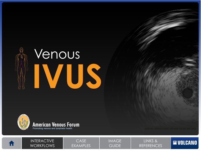 Venous IVUS