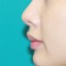 This app contains a video of the “nasal tip refinement using conchal cartilage grafts” performed by Dr