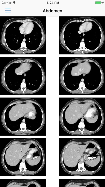 iAnatomy for Patients