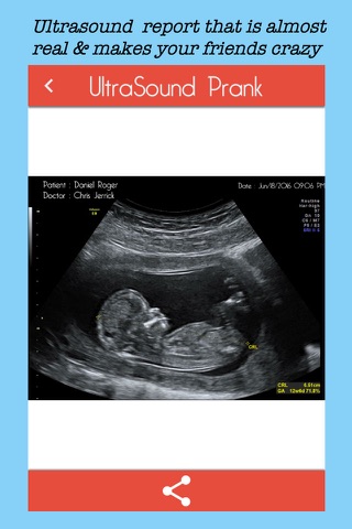 Ultrasound Prank - Best pregnancy spoof screenshot 2