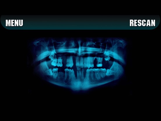 Screenshot #5 pour Simulator X-ray Teeth Prank