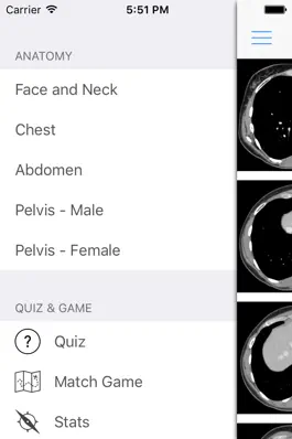 Game screenshot iAnatomy hack