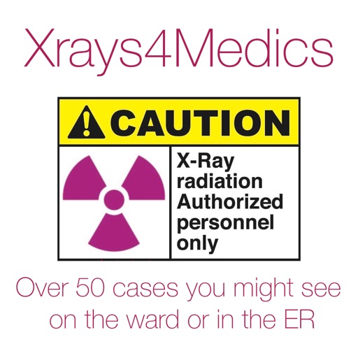 Xrays4Medics icon