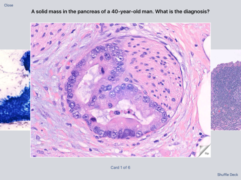 Screenshot #6 pour Johns Hopkins Flashcards