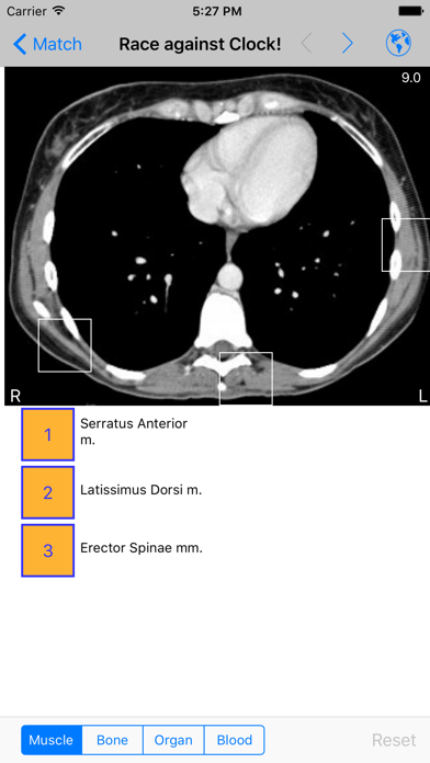 iAnatomy Screenshot 5