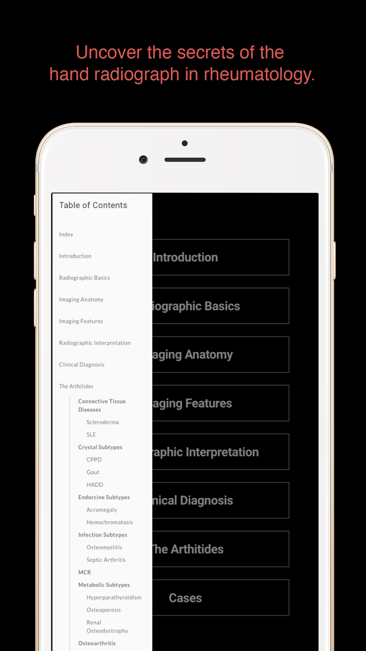 ESIMR: Uncovering The Hand Radiograph screenshot 3
