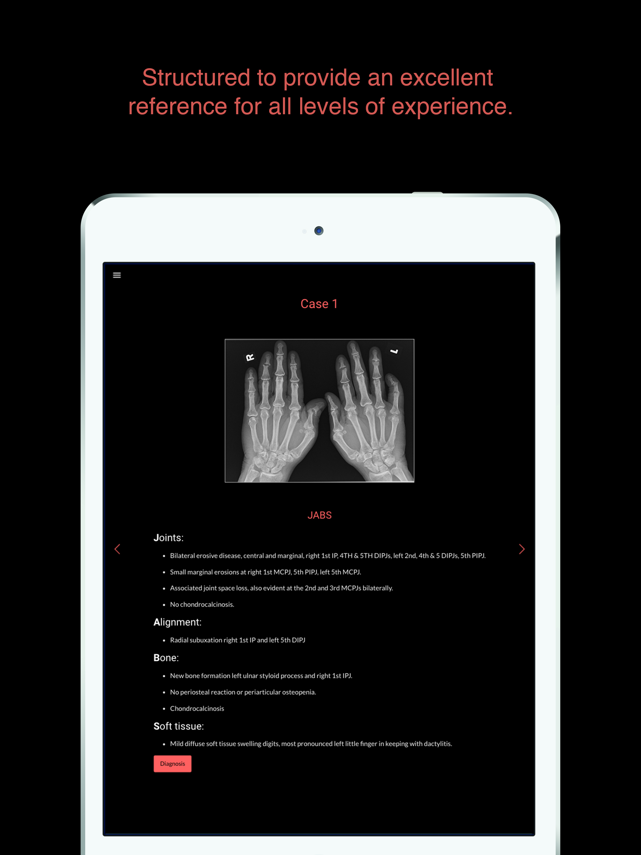 ESIMR: Uncovering The Hand Radiograph screenshot 4