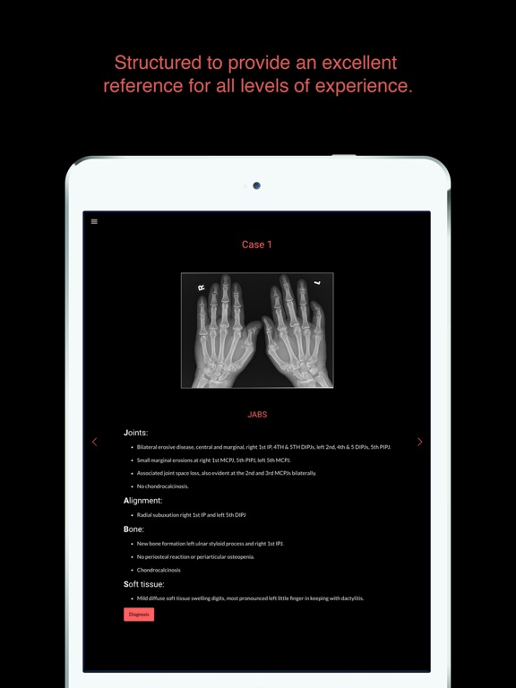 Screenshot #4 pour ESIMR: Uncovering The Hand Radiograph