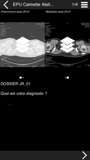 cours tdm multicoupe du thorax айфон картинки 2