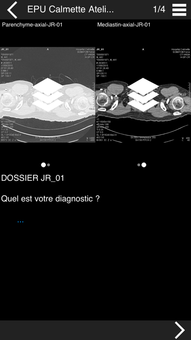 Cours TDM multicoupe du thoraxのおすすめ画像2