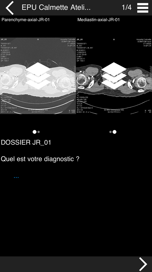 #2. Cours TDM multicoupe du thorax (iOS) 由: IMAIOS