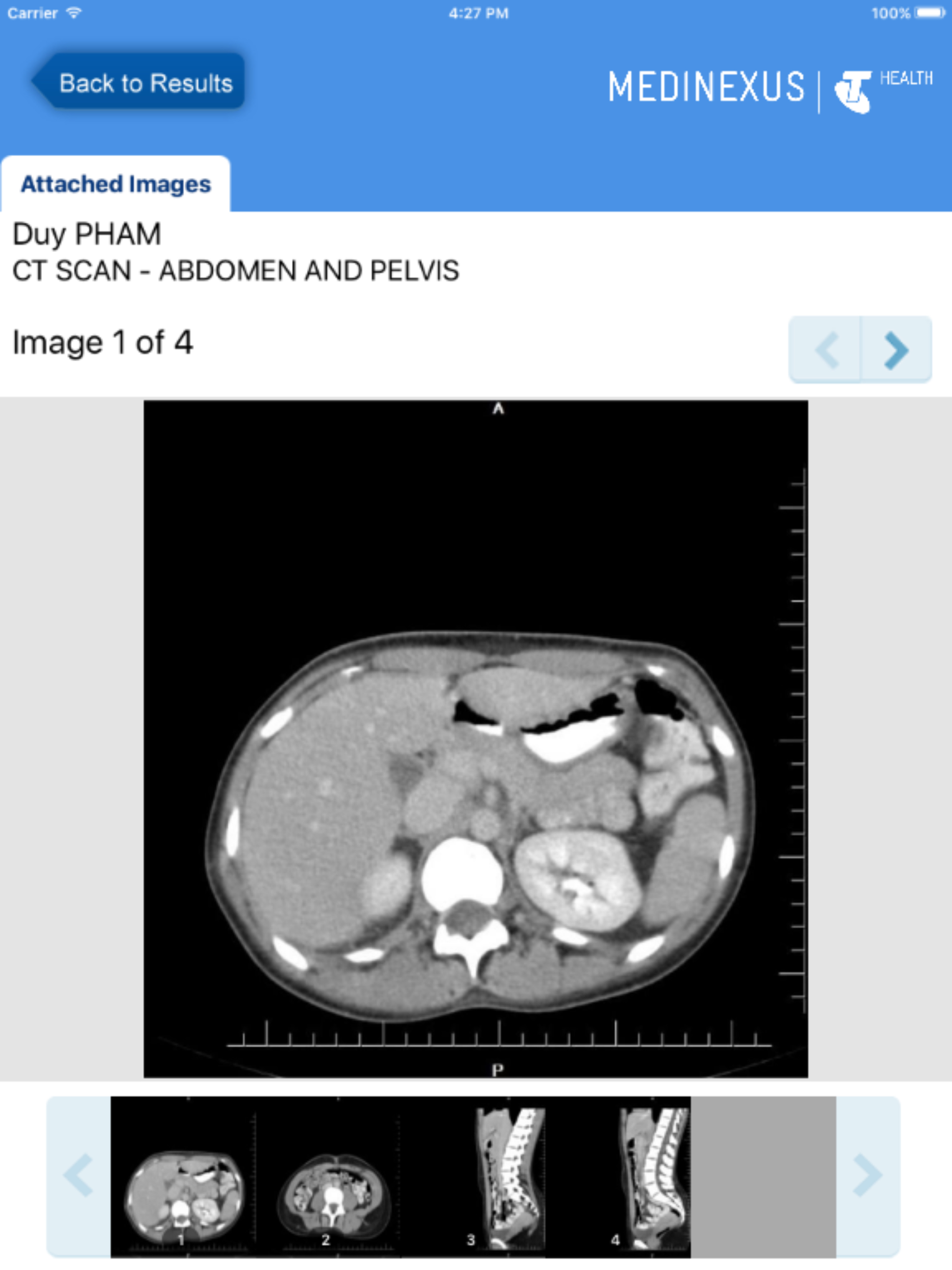 Medinexus Mobile