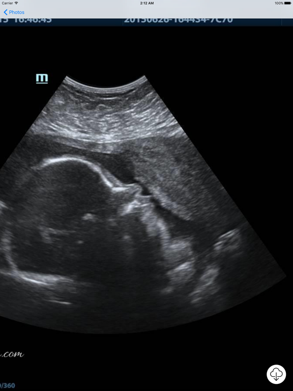 Screenshot #6 pour Your Baby Scan - Photo Locker