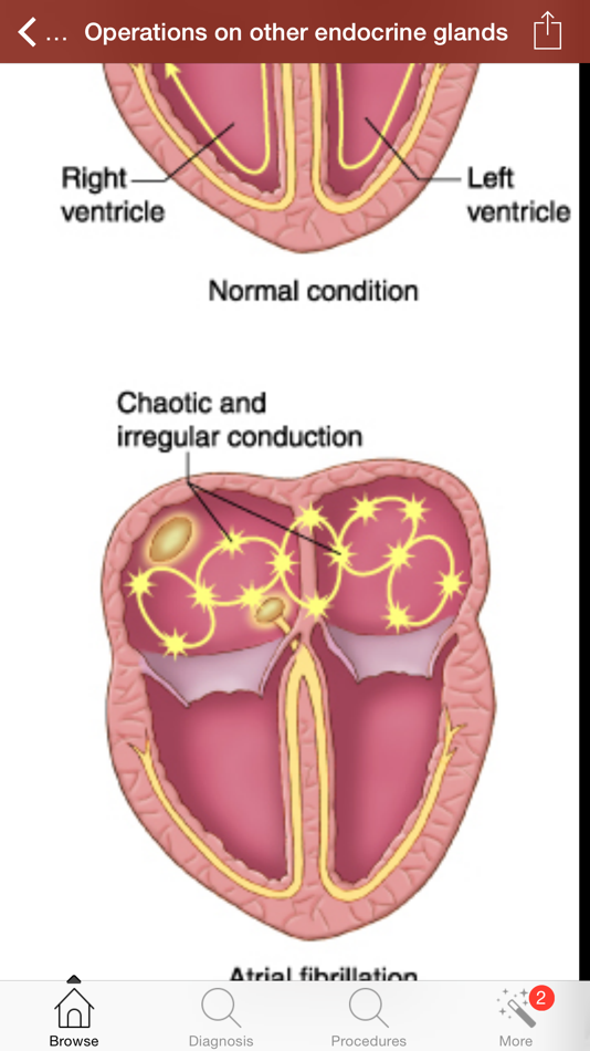 Diseases, Illnesses, Injuries - 11.1 - (iOS)