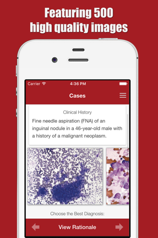 Cytopathology Case Review Atlas screenshot 2