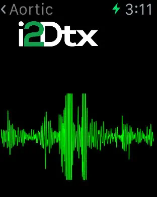 CardioSleeve