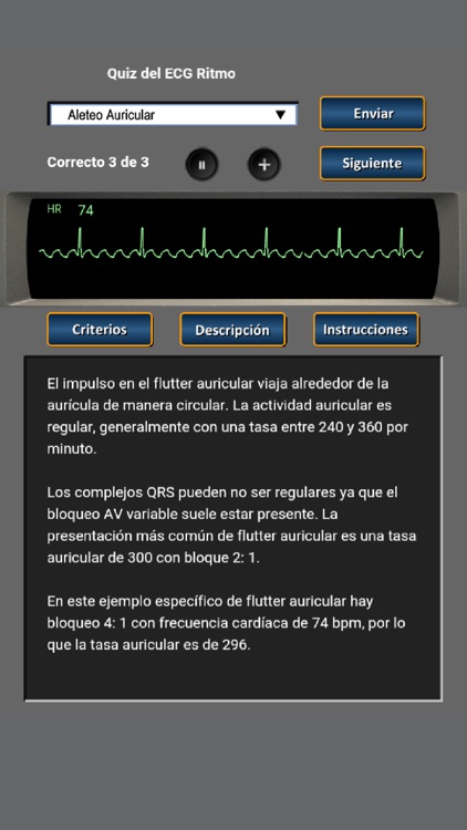 Quiz del ECG Ritmo