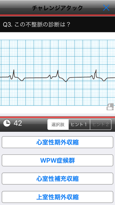 らくらく心電図トレーニング（英語モード付き）のおすすめ画像4