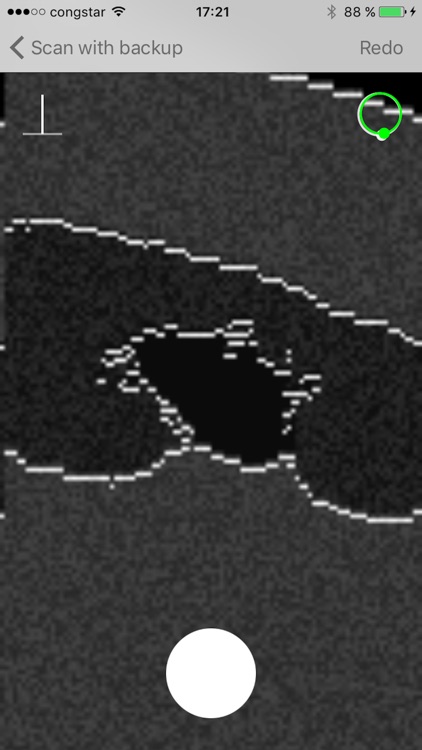 Ultraschall screenshot-3