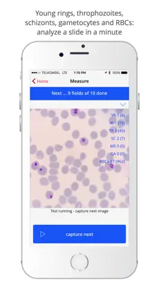 Captura 2 xRapid-Lab: the malaria parasite counter iphone